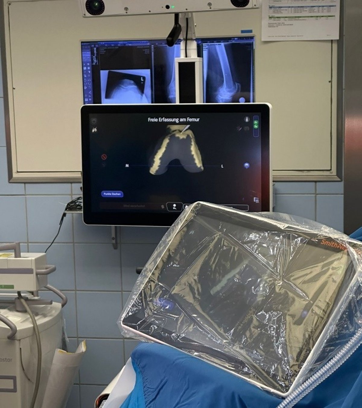 Robotik Jugenheim Bild aus dem OP-Saal mit Tablet und Monitor der Robotik-Einheit